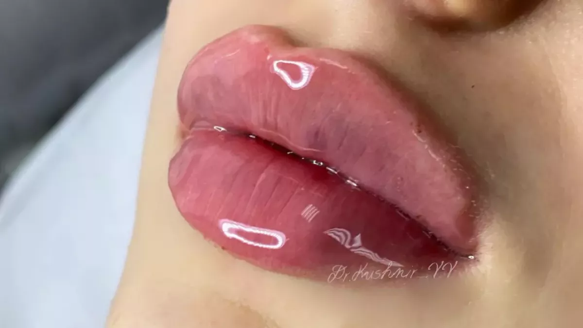 Ваш Косметолог perfect beauty studio фото 1