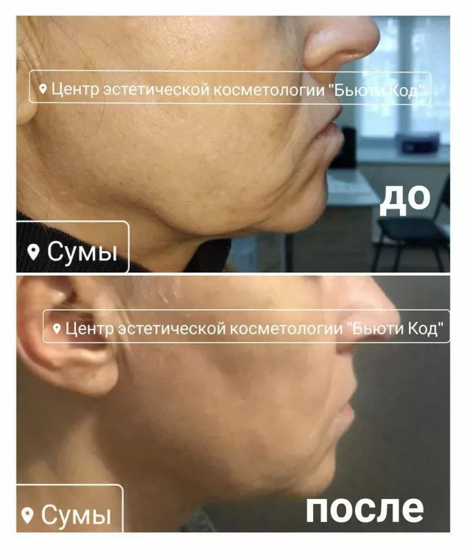 Центр Эстетической Косметологии "Бьюти Код" фото 1