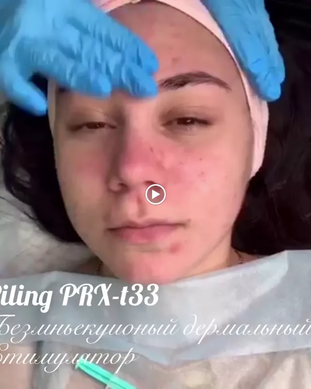 Косметолог. Увеличение губ. Ботокс. Киев. фото 1