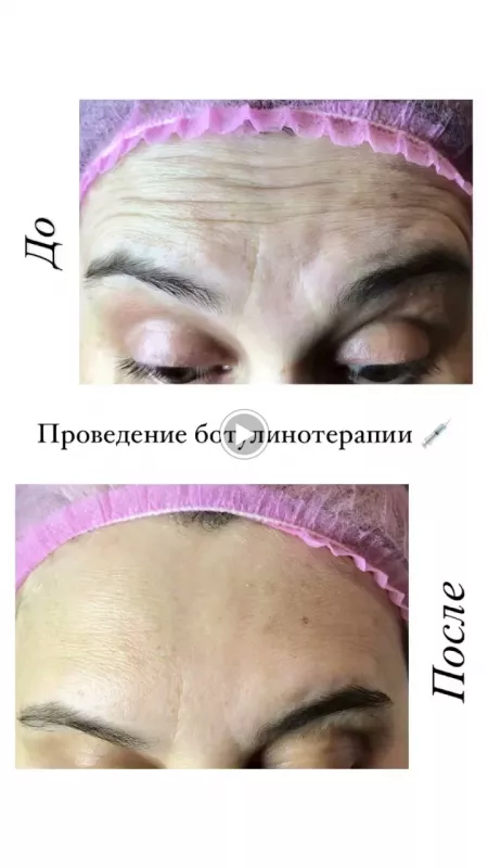 avocado_beauty_bar: Косметолог Лісовий Массив фото 1